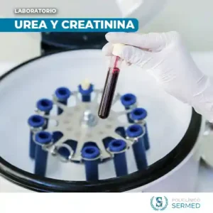 Test de urea y creatinina