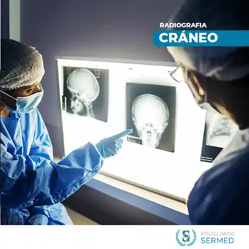 radiografia de craneo