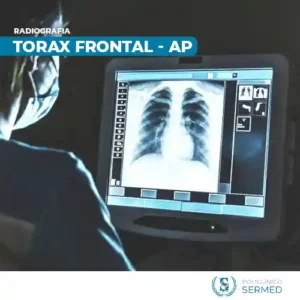 radiografia de torax